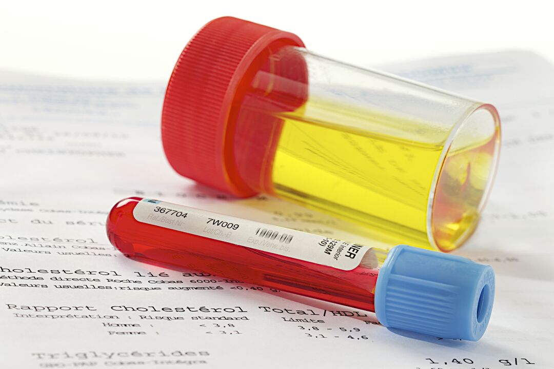 Blood and urine tests will help determine if prostatitis is present.