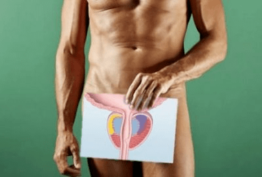 acute infectious prostatitis
