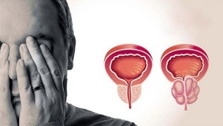 Causes of male prostatitis