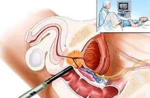 Methods of diagnosing prostatitis