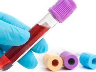 Laboratory method