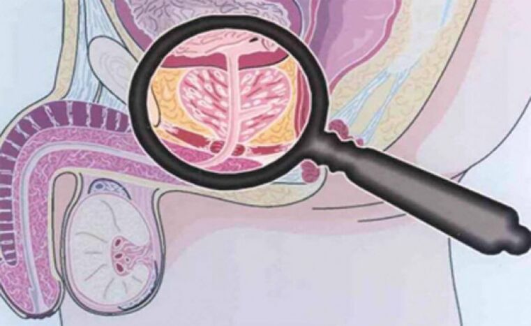 Prostate and its position