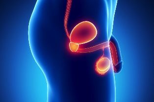 The inflammation of the prostate